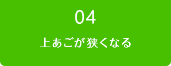 04.上あごが狭くなる
